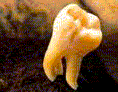 Tooth